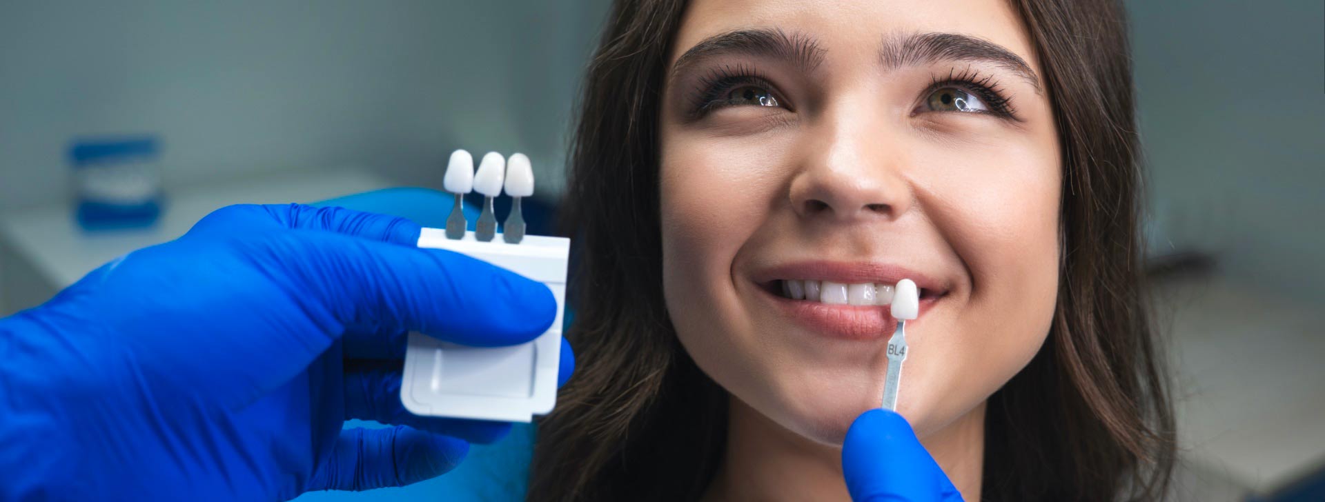 Odontoiatria Ancillotti | Faccette Dentali