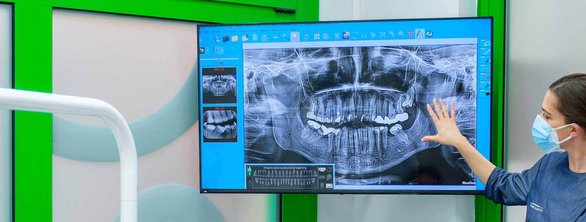 Odontoiatria Ancillotti | Digitale